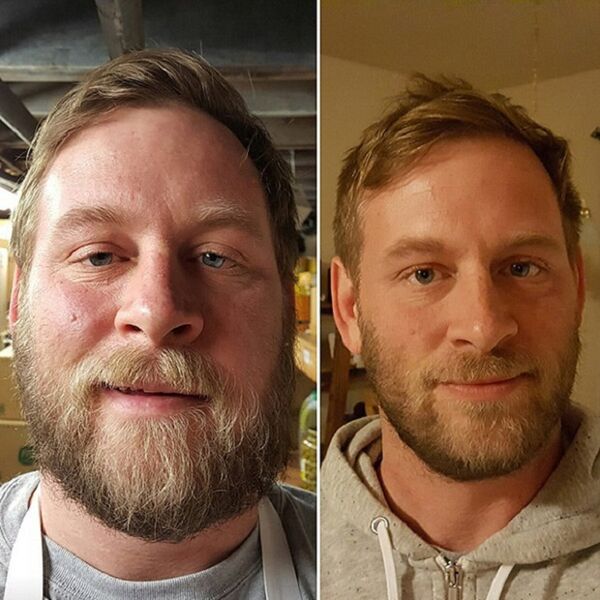 the person's appearance before and after quitting alcohol